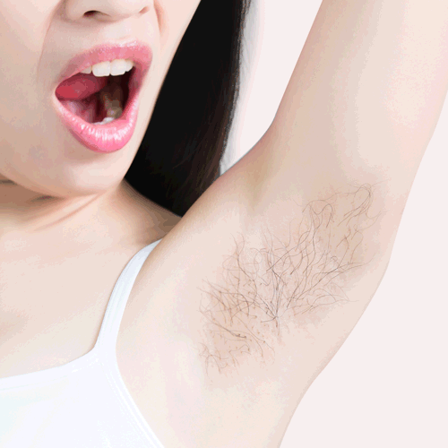 Sydonic Permanent Hair Removal Cream For Men & Women