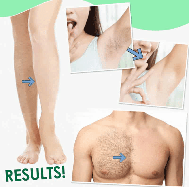 Sydonic Permanent Hair Removal Cream For Men & Women